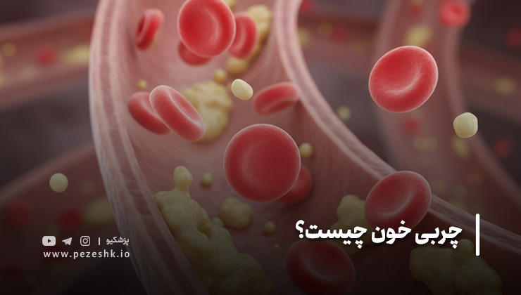 چربی خون طبیعی چقدر است؟