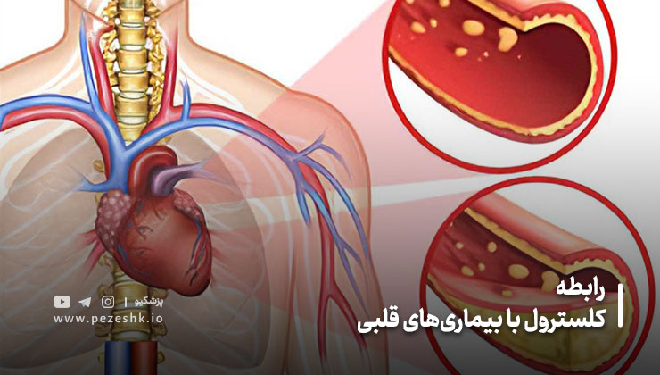 رابطه کلسترول با بیماری‌های قلبی
