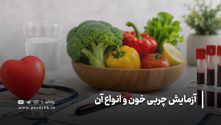 تفسیر نتایج آزمایش چربی خون؛ اعداد آزمایش چه معنایی دارند؟