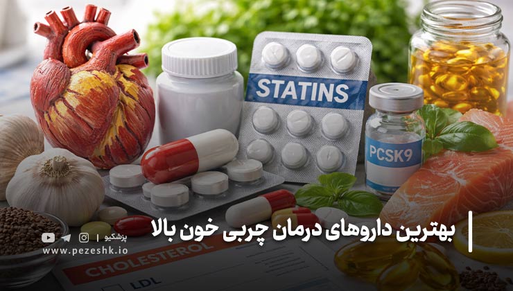 انواع داروهای مؤثر برای کاهش چربی خون