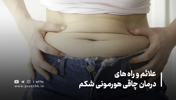 مهمترین علائم چاقی شکم هورمونی
