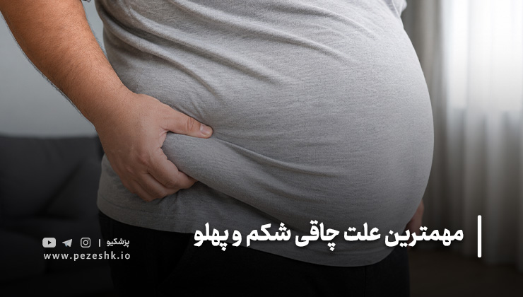 اصلی ترین علت چاقی ناگهانی شکم و پهلو چیست؟