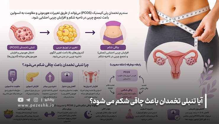 رابطه تنبلی تخمدان و چاقی شکم