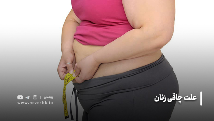علت چاقی زنان
