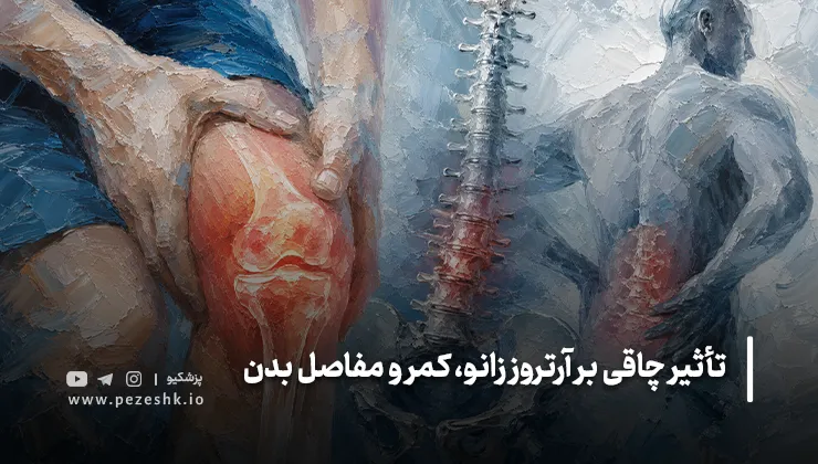 علائم آرتروز ناشی از اضافهوزن چیست؟
