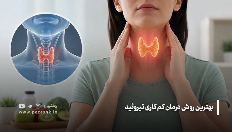 بهترین روش درمان کم کاری تیروئید