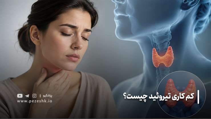 hypothyroidism