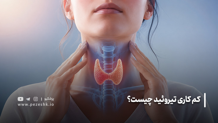 کم کاری تیروئید