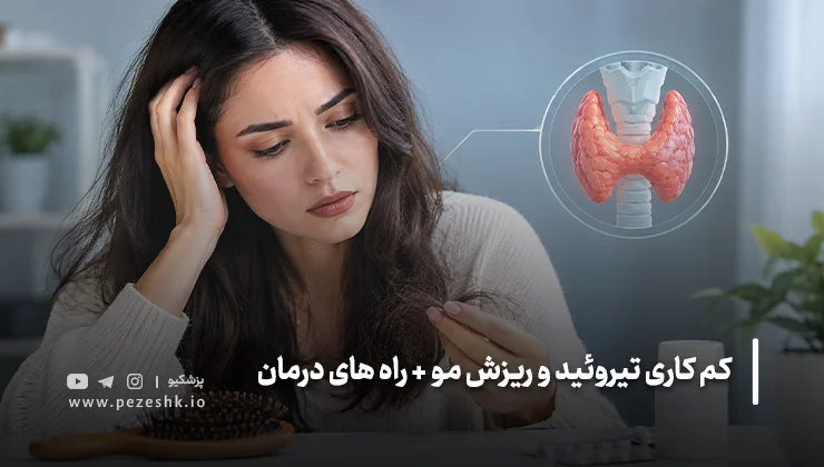 ریزش موی ناشی از کمکاری تیروئید چه شکلی است؟